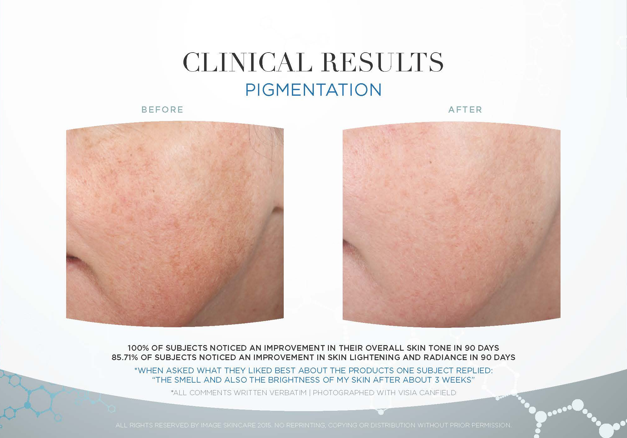 Pigmentation-Clinical-Study-Photos