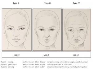 Natural face lifting